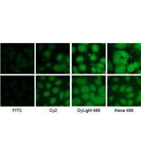 Jackson公司優(yōu)質(zhì)二抗